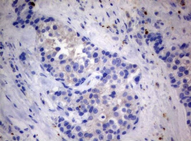 MFN1 Antibody in Immunohistochemistry (Paraffin) (IHC (P))