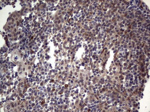 TET1 Antibody in Immunohistochemistry (Paraffin) (IHC (P))