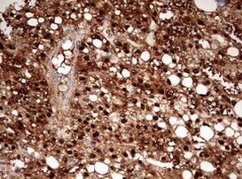 ASL Antibody in Immunohistochemistry (Paraffin) (IHC (P))