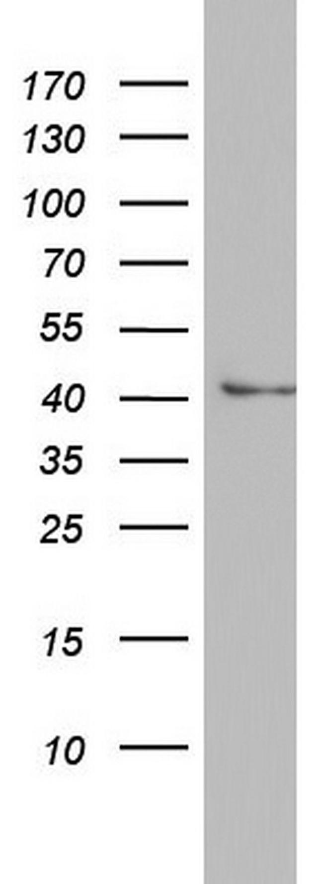 ASL Antibody in Western Blot (WB)