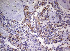 NDUFS2 Antibody in Immunohistochemistry (Paraffin) (IHC (P))