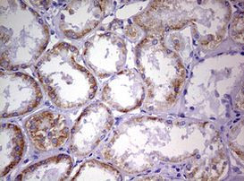 NDUFS2 Antibody in Immunohistochemistry (Paraffin) (IHC (P))