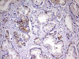 NDUFS2 Antibody in Immunohistochemistry (Paraffin) (IHC (P))