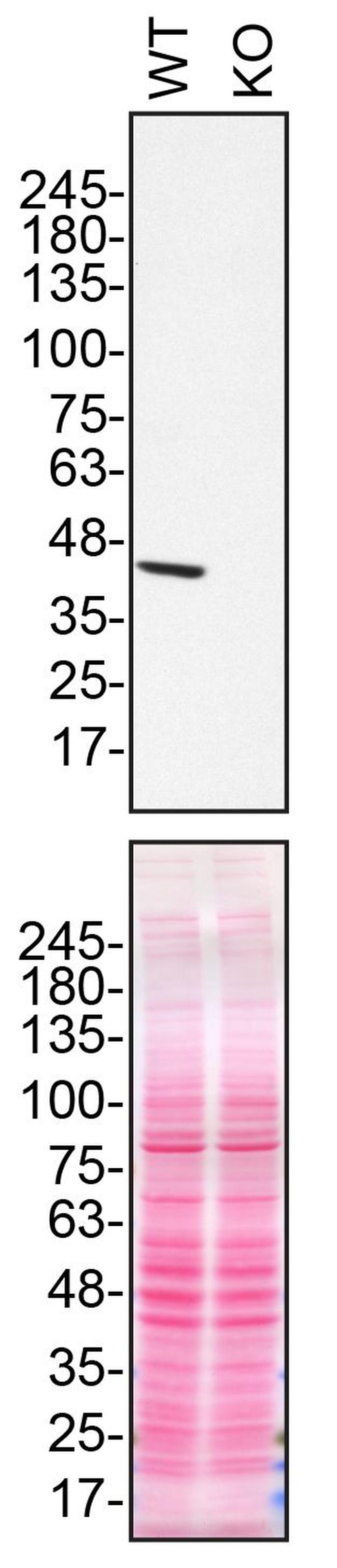 NDUFS2 Antibody in Western Blot (WB)