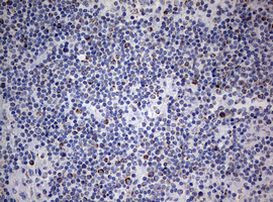 NDUFS2 Antibody in Immunohistochemistry (Paraffin) (IHC (P))