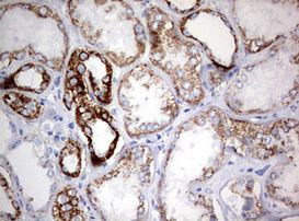 NDUFS2 Antibody in Immunohistochemistry (Paraffin) (IHC (P))