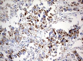 NDUFS2 Antibody in Immunohistochemistry (Paraffin) (IHC (P))