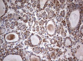 NDUFS2 Antibody in Immunohistochemistry (Paraffin) (IHC (P))