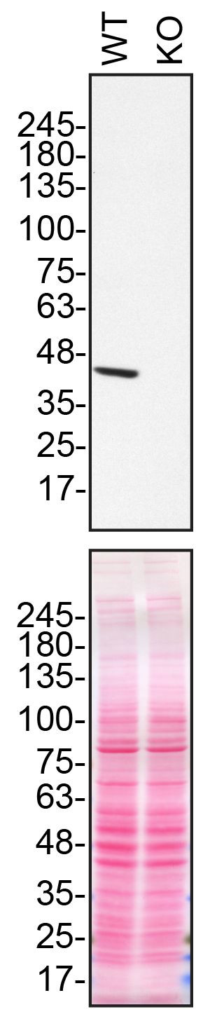 NDUFS2 Antibody