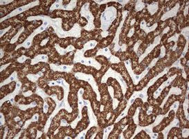 OTC Antibody in Immunohistochemistry (Paraffin) (IHC (P))