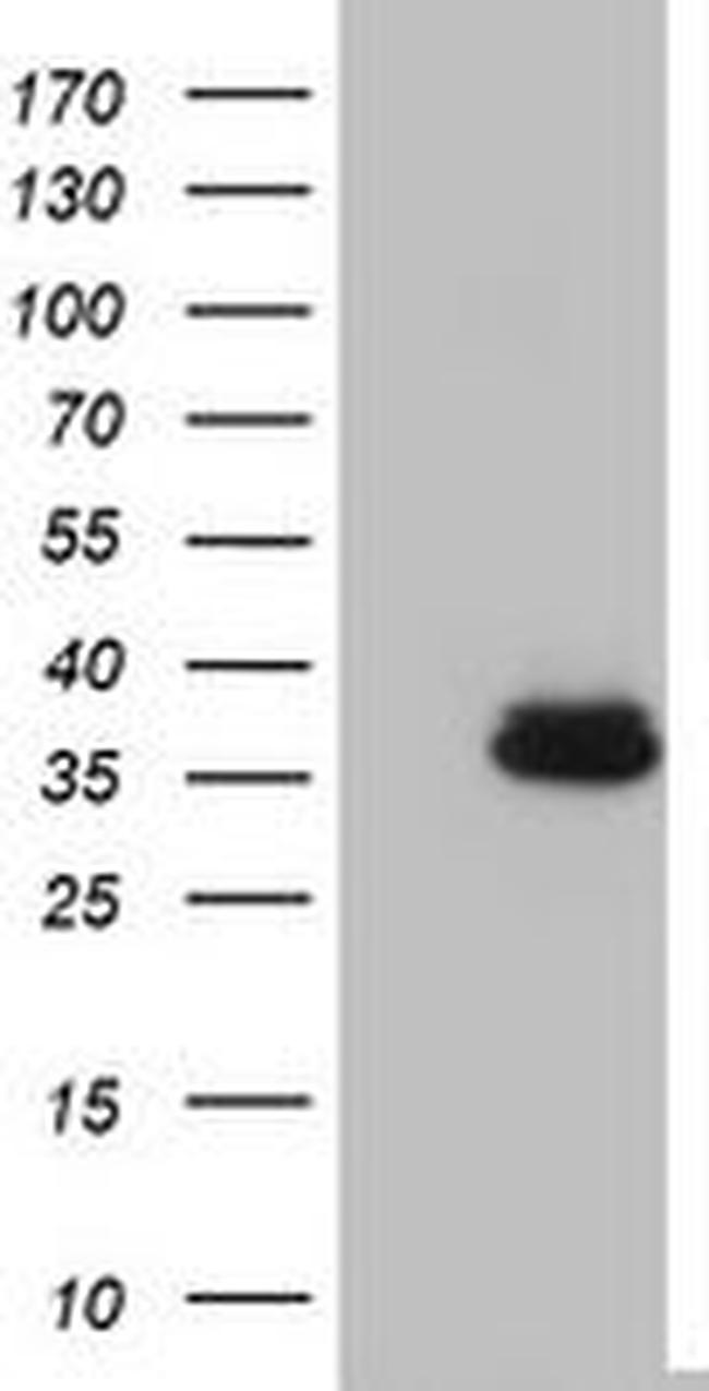 OTC Antibody in Western Blot (WB)