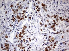 PARN Antibody in Immunohistochemistry (Paraffin) (IHC (P))