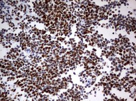 PARN Antibody in Immunohistochemistry (Paraffin) (IHC (P))