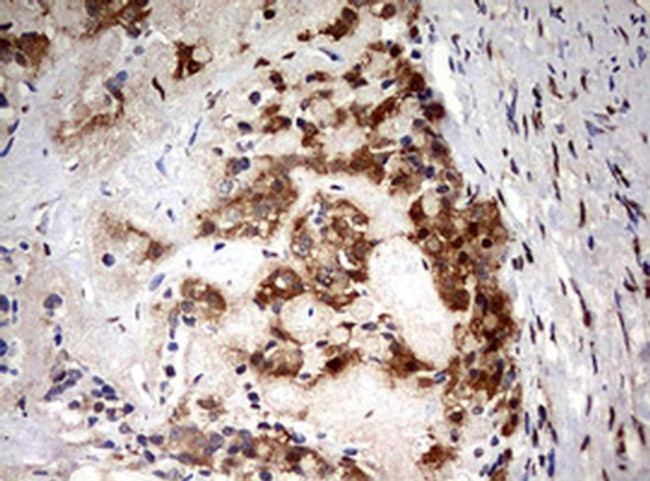 HMBS Antibody in Immunohistochemistry (Paraffin) (IHC (P))