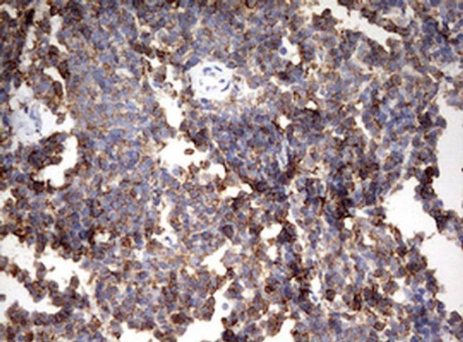 HMBS Antibody in Immunohistochemistry (Paraffin) (IHC (P))