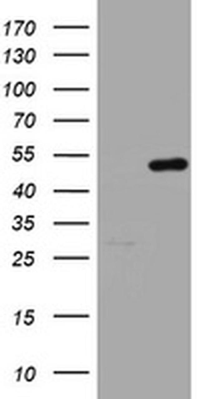 HMBS Antibody in Western Blot (WB)