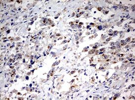 PARN Antibody in Immunohistochemistry (Paraffin) (IHC (P))