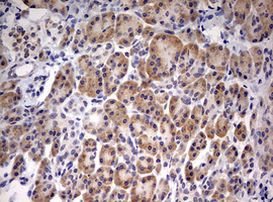 PARN Antibody in Immunohistochemistry (Paraffin) (IHC (P))