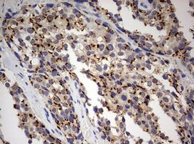 PARN Antibody in Immunohistochemistry (Paraffin) (IHC (P))