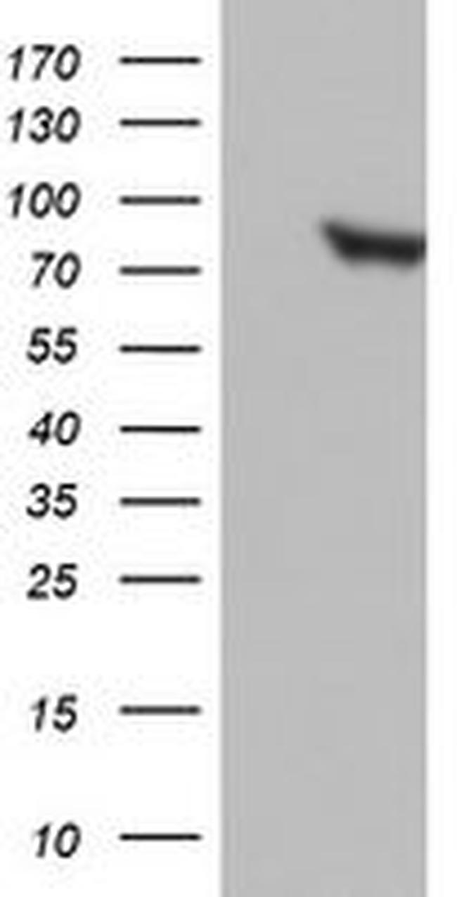 PARN Antibody in Western Blot (WB)