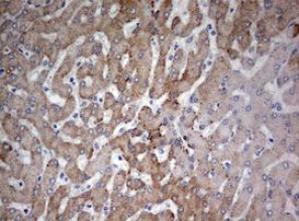 FEN1 Antibody in Immunohistochemistry (Paraffin) (IHC (P))