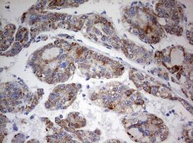 FEN1 Antibody in Immunohistochemistry (Paraffin) (IHC (P))