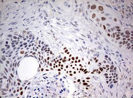 FEN1 Antibody in Immunohistochemistry (Paraffin) (IHC (P))