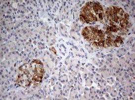 FEN1 Antibody in Immunohistochemistry (Paraffin) (IHC (P))