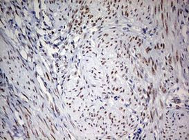 FEN1 Antibody in Immunohistochemistry (Paraffin) (IHC (P))