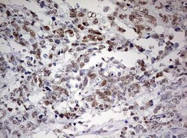 FEN1 Antibody in Immunohistochemistry (Paraffin) (IHC (P))