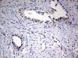 FEN1 Antibody in Immunohistochemistry (Paraffin) (IHC (P))