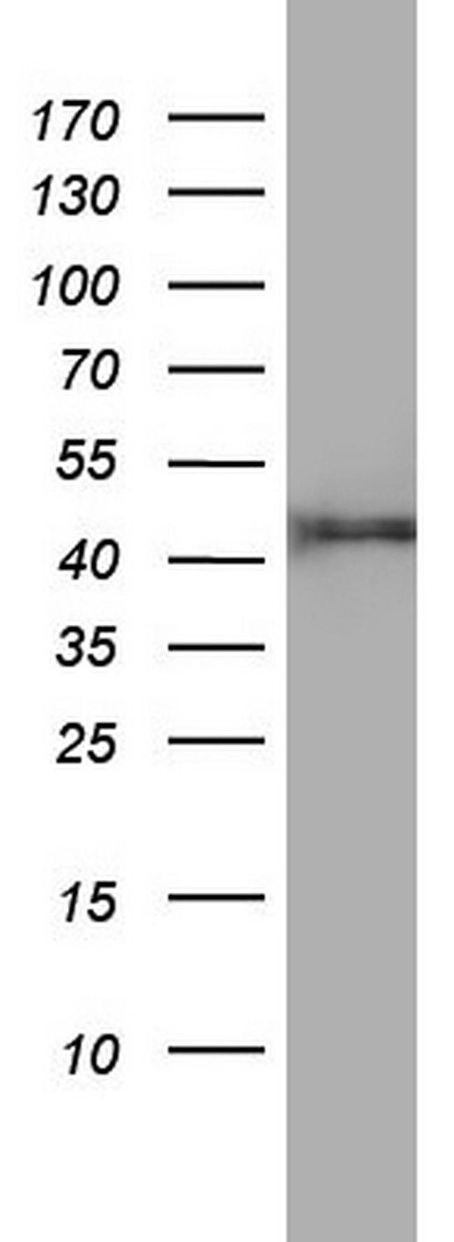 FEN1 Antibody in Western Blot (WB)