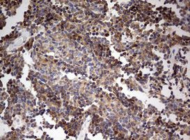 OAS2 Antibody in Immunohistochemistry (Paraffin) (IHC (P))