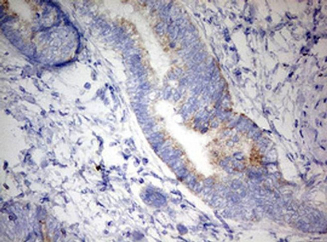 DAP3 Antibody in Immunohistochemistry (Paraffin) (IHC (P))