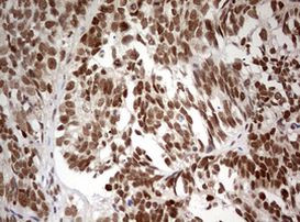 TRIM24 Antibody in Immunohistochemistry (Paraffin) (IHC (P))