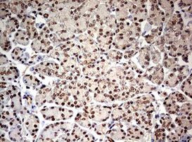 TRIM24 Antibody in Immunohistochemistry (Paraffin) (IHC (P))