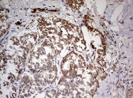 TRIM24 Antibody in Immunohistochemistry (Paraffin) (IHC (P))