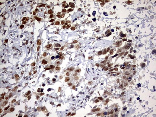 DDX56 Antibody in Immunohistochemistry (Paraffin) (IHC (P))