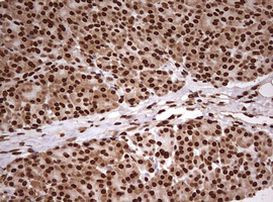 FBXW7 Antibody in Immunohistochemistry (Paraffin) (IHC (P))