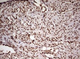 FBXW7 Antibody in Immunohistochemistry (Paraffin) (IHC (P))