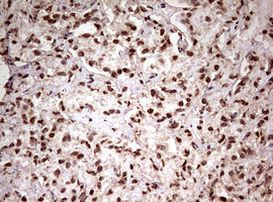 FBXW7 Antibody in Immunohistochemistry (Paraffin) (IHC (P))