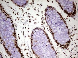 FBXW7 Antibody in Immunohistochemistry (Paraffin) (IHC (P))