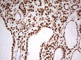 FBXW7 Antibody in Immunohistochemistry (Paraffin) (IHC (P))