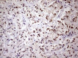 FBXW7 Antibody in Immunohistochemistry (Paraffin) (IHC (P))