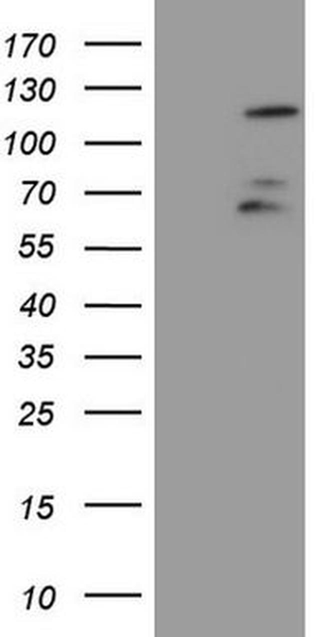 FBXW7 Antibody in Western Blot (WB)