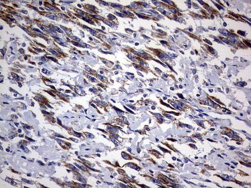 DAP3 Antibody in Immunohistochemistry (Paraffin) (IHC (P))