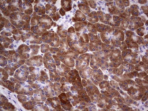 TIPIN Antibody in Immunohistochemistry (Paraffin) (IHC (P))