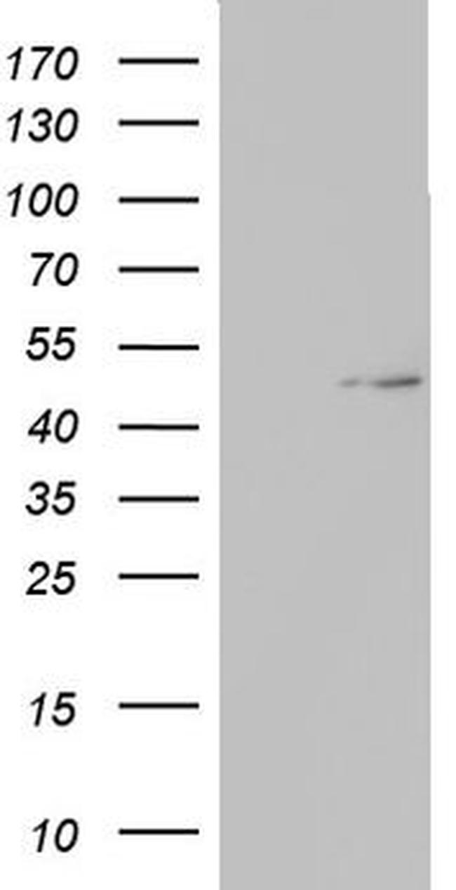 TIPIN Antibody in Western Blot (WB)