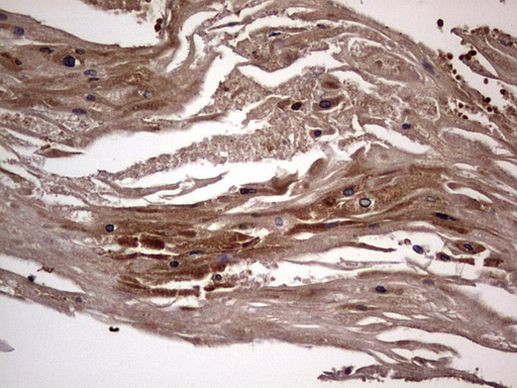 DOCK8 Antibody in Immunohistochemistry (Paraffin) (IHC (P))