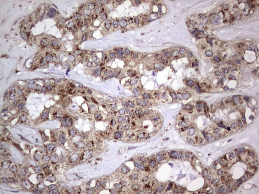 DOCK8 Antibody in Immunohistochemistry (Paraffin) (IHC (P))